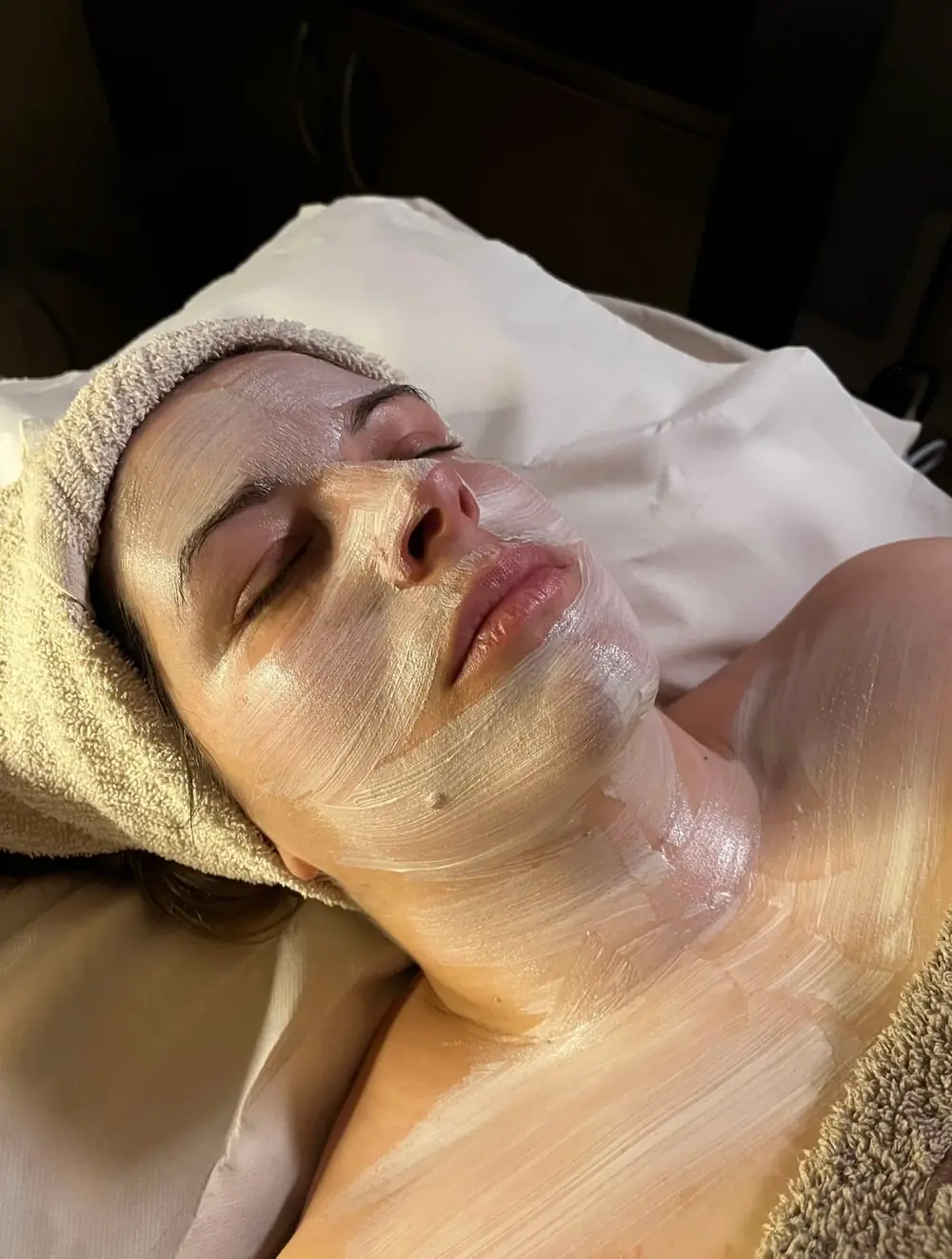 Peeling Glow