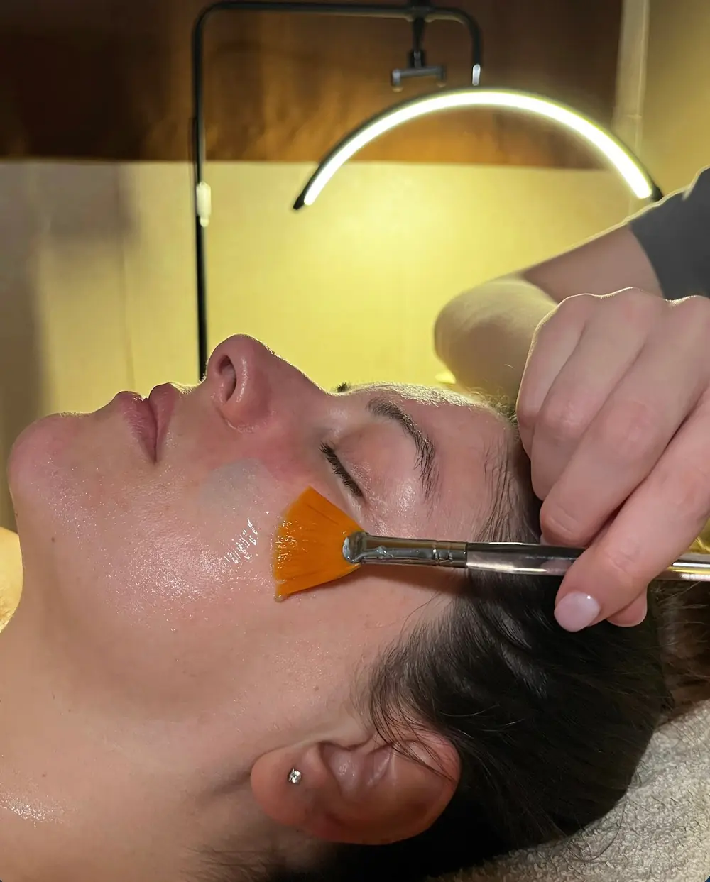 Peeling Renew