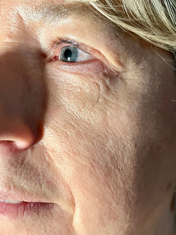 Trattamenti Anti-Age